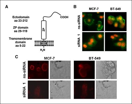Figure 2. PLAC1 is a cell surface protein. A, predicted topology and structure of PLAC1 protein. Staining of methanol-fixed (B) and nonfixed (C) MCF-7 and BT-549 breast cancer cells with anti-PLAC1/C-term antibody after transfection with PLAC1-specific siRNA (siRNA1) or nonsilencing siRNA.