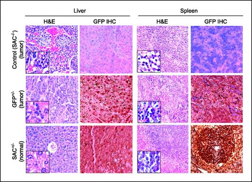 Figure 3. Tumor development is inhibited in SAC transgenic mice. Sections of the liver and spleen from SAC or GFP transgenic and nontransgenic control littermates (of SAC-GFP mice) were subjected to either H&E staining to reveal tissue topography or immunohistochemistry (IHC) with the GFP antibody to ascertain transgene expression. Magnification, ×10 for all panels. Inset, magnification of tumor or normal sections, ×40.