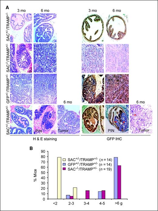 Figure 4. Prostate tumor development is inhibited in SAC transgenic mice. A, the prostates of offspring with the indicated genotypes resulting from the indicated crosses between the transgenic and TRAMP mice were sectioned and subjected to either H&E staining to identify areas of normal prostate, PIN, or adenocarcinoma (left), or to immunohistochemistry with the GFP antibody to ascertain transgene expression (right). Red arrows, loss of SAC expression in the PIN lesions and adenocarcinoma from SAC+/−/TRAMP+/− mice at 3 and 6 mo, respectively. Magnification, all panels, ×10. B, the prostates of offspring with the indicated genotypes were weighed at 6 mo of age, and the percentage of mice with prostates falling within various weight groups is shown.
