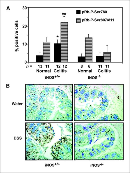 Figure 1. pRb hyperphosphorylation is mediated by iNOS in DSS-treated mouse colons. A, iNOS−/− and iNOS+/+ mice were fed 4% DSS in drinking water for three cycles. pRb phosphorylation was examined at Ser780 and Ser807/811 by immunohistochemistry. These sites of phosphorylation were significantly increased in DSS-treated iNOS+/+ mice but not in iNOS−/− mice. B, representative photomicrographs of phosphorylated pRb at indicated sites. Magnification, ×400.