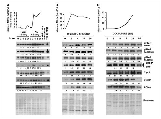 Figure 2. NO species increase pRb phosphorylation in three cell culture systems. A, endogenous NO produced by excess l-arginine (L-Arg; 200 μmol/L) causes an increase in pRb phosphorylation at Ser780, Ser807, Ser811, Thr821, and Thr826 in HCT116 colon cancer cells. The iNOS inhibitor aminoguanidine (AG) was added to control HCT116 cells (lanes 1–5) to eliminate endogenous NO production. Levels of E2F1 downstream molecules, cyclins D1 (CycD) and PCNA, were elevated. This observation was also seen in SPER/NO-treated HT29 colon cancer cells (B) and HT29 colon cancer cells cocultured with ANA-1 mouse macrophages (C). In the latter cases (B and C), cyclin A (CycA) levels were also elevated. For the coculture experiment (C), colon cancer cells were separated from ANA-1 cells following incubation to ensure end point observation in target colon cells only.