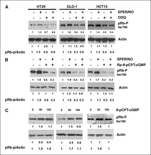 Figure 4. The sGC/cGMP/PKG pathway is involved in NO-mediated pRb phosphorylation. A, the sGC inhibitor ODQ inhibits SPER/NO-induced pRb phosphorylation in human colon cancer cell lines. B, the PKG inhibitor Rp-8-pCPT-cGMP also inhibits SPER/NO-induced pRb phosphorylation in human colon cancer cell lines. C, the cGMP mimetic 8-pCPT-cGMP stimulates pRb phosphorylation.