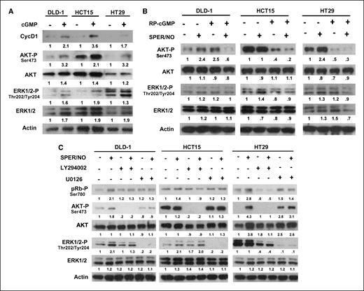 Figure 5. The PI3K/AKT and MEK/ERK1/2 pathways affect NO-induced pRb phosphorylation independently. A, the cGMP mimetic 8-pCPT-cGMP (cGMP) increases AKT and ERK1/2 phosphorylation and cyclin D1 level. B, the cGMP antagonist Rp-8-pCPT-cGMP (RP-cGMP) inhibits AKT and ERK1/2 phosphorylation after SPER/NO treatment. C, LY294002 and U0126 effectively inhibit AKT and ERK1/2 phosphorylation, respectively. NO-induced pRb phosphorylation decreases when AKT and ERK1/2 phosphorylation are inhibited individually.
