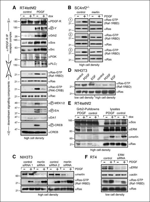 Figure 3. Dissection of the PDGF-dependent signaling pathway. A, autophosphorylation of the PDGFR as well as the binding of adaptor proteins and enzymes is not affected by active merlin. RT4tetNf2 cells were plated at a high density, treated with doxycycline, and serum starved overnight before treatment with PDGF for 3 min. From lysates, PDGFR was immunoprecipitated (8). Immunoblots were consecutively probed with antibodies against phosphorylated tyrosine, PDGFR, and the coimmunoprecipitated proteins Grb2, Sos, Src, PI3K, and PLCγ. Merlin inhibits PDGF-induced activation of the small G-proteins Ras and Rac. Lysates from the same experiments were immunoblotted for the activation of MEK, ERK, and CREB as indicated, or treated with either Raf-1RBD (for Ras-GTP) or CRIB-PAK (for Rac-GTP) to coprecipitate activated Ras and Rac, which was then detected by immunoblotting. B, physiologic levels of merlin inhibit PDGF-induced activation of Ras. The merlin expression clones in SC4 nf2−/− cells described in Fig. 2B were treated as in (E). Lysates were treated with Raf-1RBD to coprecipitate Ras-GTP, which was subsequently detected by immunoblotting. C, down-regulation of merlin by RNAi in NIH3T3 cells caused an increase in Ras activity. NIH3T3 cells were treated with siRNA against merlin or control siRNAs (as in Fig. 2C) for 36 h, replated at high cell density, and lysed. The lysates were treated as in (B). D, Ras-GTP in low- and high-density cells. NIH3T3 cells were grown to different densities (see Materials and Methods) and treated or not with PDGF and EGF. Ras-GTP was determined as in (A and B). E, merlin blocks the formation in vitro of a putative Ras activation complex. Components involved in the activation of Ras were assembled in vitro with GST-Grb2 added to the lysates. Pulldowns were as described in Materials and Methods. Immunoblots of the components are shown. F, down-regulation of ERM by RNAi in RT4 cells inhibited Ras activity. RT4 cells were treated with siRNA against ERM or control siRNAs (as in Fig. 2C) for 36 h, replated at low cell density, and lysed. The lysates were treated as in (B).