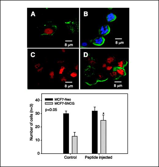 Figure 5. ANK peptide microinjected MCF7-SNCG cells show similar sensitivity to antimicrotubule drug nocodazole as MCF7-Neo control cells. The ANK peptide (1 μmol/L stock in needle) was microinjected together with goat IgG (1 mg/mL) and FITC (5 mg/mL; Molecular Probes) into the MCF7-SNCG or MCF7-Neo cells under a ×40 magnification of phase contrast microscope (Carl Zeiss, Inc., Jena, Germany) using a pressure injection system (Femtojet, Eppendorf, Hamburg, Germany). Cells were fixed with paraformaldehyde and then visualized using DAPI (blue). Red is pseudo-color for DAPI-stained DNA in control cells. Microinjected cells were identified using green from goat IgG probed with donkey anti-goat IgG labeled with Alex Fluor 488 (Roche). Fluorescent cells were visualized using a ×100 objective (oil) on an inverted confocal microscope (Leica). A, MCF7-SNCG cells injected with IgG and treated with 0.5 μmol/L nocodazole. B, MCF7-SNCG cells injected with ANK and treated with 0.5 μmol/L nocodazole. C, uninjected MCF7-SNCG cells treated with 0.5 μmol/L nocodazole. D, untreated MCF7-SNCG cells injected with ANK. Bottom, statistics of the viability of MCF7-Neo control cells versus MCF7-SNCG cells. Y-axis, number of cells undergoing mitotic arrest. Left, uninjected cells; right, ANK peptide-injected cells, both treated with antimicrotubule drug nocodazole. MCF7-Neo cells were not significantly affected by microinjection of ANK peptide (see black columns). MCF7-SNCG cells microinjected with the ANK peptide exhibited a significant (P < 0.05) increase in the number of cells in mitotic arrest (see gray columns).