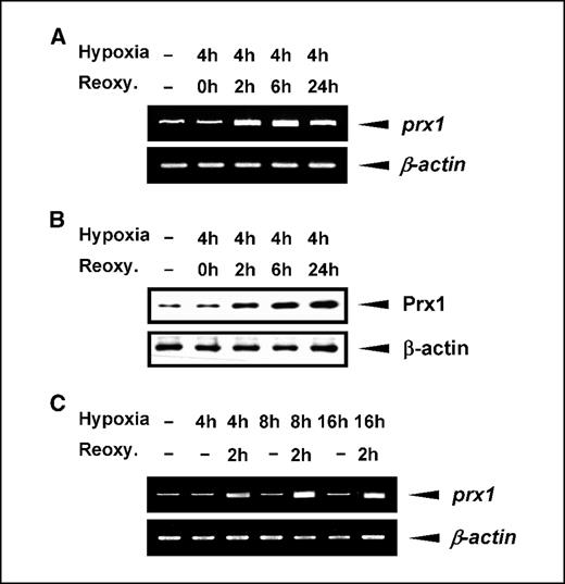 Figure 1. Up-regulation of prx1 expression by hypoxia/reoxygenation. A, human lung cancer A549 cells were exposed to hypoxia for 4 h, followed by reoxygenation for 0, 2, 6, or 24 h. Total RNA was isolated, and reverse transcription-PCR analysis was carried out using primer pairs specific for human prx1 gene. β-actin gene was used as a control. B, protein extracted from cells treated as above was subjected to Western blot analysis. Equal amounts of protein (10 μg) were separated by SDS-PAGE and probed with an antibody specific to Prx1. β-actin was used as a loading control. C, cells were exposed to 4, 8, or 16 h of hypoxia, followed by 2 h of reoxygenation. Total RNA was isolated, and reverse transcription-PCR was carried out using human prx1 primer pairs. β-actin gene was used as a control.