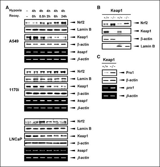 Figure 5. Reduction of Keap1 protein in response to hypoxia/reoxygenation. A, A549, 1170i, and LNCaP cells were exposed to 4 h of hypoxia and reoxygenated for 0, 0.5, 2, 6, or 24 h. Nuclear and cytosolic protein extracts were prepared from each cell line and subjected to Western blot analysis with an anti-Nrf2 and an anti-Keap1 antibody, respectively. Lamin B is a loading control for nuclear fraction, and β-actin is a loading control for cytosolic fraction. Total RNA was isolated from and reverse transcription-PCR was done using the primer pairs specific for the human keap1 mRNA. β-actin gene was analyzed as a control. B, equal amounts of cytoplasmic and nuclear protein from Keap1 +/+ and Keap1 −/− MEF cells were subjected to Western blot analysis using an anti-Nrf2 or anti-Keap1 antibody. Western blots of β-actin and lamin B were carried out as the loading control for cytoplasmic and nuclear protein, respectively. C, total protein extract from Keap1 +/+ or −/− cells was subjected to Western blot using an antibody specific to Prx1. β-actin was used as a loading control. Total RNA from Keap1 +/+ or −/− cells were subjected to reverse transcription-PCR analysis using primer pairs specific to the mouse prx1. Mouse β-actin gene was analyzed as a control.