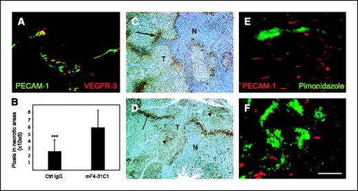 Figure 5. Anti-VEGFR-3–treated tumors show increased necrosis. A, sections from NCI-H460-LNM35 tumors were stained for VEGFR-3 (red). Blood vessels were visualized by anti-PECAM-1 staining (green). B, quantification of necrotic areas in mF4-31C1- and control antibody–treated tumors. Bars, SD. C and D, tumors were excised and hypoxic areas were visualized with a monoclonal antibody that recognizes pimonidazole adducts in hypoxic tissue (C and D, brown). Arrows, rim of hypoxic cells between the necrotic areas (N; blue staining) and viable tumor mass. Note that in the mF431C1-treated tumors, tumor cells inside the tumor mass stain brown for the hypoxia marker (D, black arrows). E and F, thick (100 μm) tumor sections were stained with antibodies against PECAM-1 (red) and pimonidazole adducts (green). The mF4-31C1-treated tumors (F) contained fewer blood vessels but larger hypoxic areas when compared with control antibody–treated tumors (E). T, viable tumor tissue. Magnification ×200 (A), ×100 (C–F). ***, P < 0.001. Bar, 50 μm.