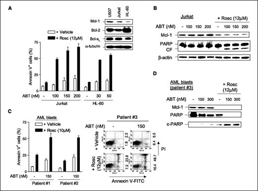 Figure 2. Roscovitine down-regulates Mcl-1 and promotes ABT-737 lethality in multiple human leukemia cell lines and primary AML cells. A, untreated U937, HL-60, and Jurkat cells were lysed and subjected to immunoblot analysis to detect protein levels of Bcl-2, Bcl-xL, and Mcl-1 (inset). Jurkat and HL-60 cells were exposed for 24 h to ABT-737 (Jurkat, 100–200 nmol/L; HL-60, 30–50 nmol/L) ± 12 μmol/L roscovitine, after which the percentage of Annexin V+ cells was determined by flow cytometry. B, Jurkat cells were treated as described in (A), after which immunoblot analysis was done to monitor Mcl-1 expression and PARP cleavage. C, blasts were isolated from the peripheral blood of three AML patients (designed as #1–3; FAB subtype M2) and then incubated (24 h) with 150 nmol/L ABT-737 ± roscovitine (#1 and #2, 10 μmol/L; #3, 12 μmol/L). At the end of this period, the percentage of Annexin V+ cells was determined by flow cytometry. Columns, means for an experiment done in triplicate; bars, SD. Representative experiment (patient #3). D, the blasts (patient #3) were incubated (24 h) with 150 and 300 nmol/L ABT-737 ± 12 μmol/L roscovitine and then lysed for immunoblot using indicated primary antibodies. C-PARP, cleaved PARP. A (inset), B, and D, representative for three separate experiments.