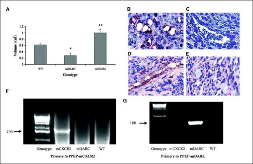 Figure 1. A, Mela-MIP-2+ cells (10 × 106/200 μL/PBS) were injected s.c. into WT, PPEP-mCXCR2, and PPEP-mDARC mice. Tumors were excised from all mice at the time point at which the first tumor reached maximum size in any dimension (1.5 cm). In two independent experiments, these time points were 41 and 45 d, respectively. Tumor volume was determined by fluid displacement. The graph shows the mean tumor volume of all tumors from all mice included in both experiments. The Student's t test was used to evaluate the statistical significance of variance between the groups of mice. *, P < 0.05; **, P < 0.005. Confirmation of overexpression of the transgenes mCXCR2 and mDARC in melanoma tumors growing on transgenic using polyclonal antibodies directed against mCXCR2 or mDARC. Immunolocalization of mCXCR2 in melanoma tumor xenografts derived from the PPEP-mCXCR2 mouse B compared with CXCR2 expression in WT mice C based on staining with polyclonal antibody to mCXCR2. Immunolocalization of mDARC in melanoma tumor xenografts derived from the PPEP-DARC mice D compared with mDARC staining in tumor xenografts from WT mice E, stained with polyclonal antibody to mDARC. Magnification, ×40. PCR confirmation of transgene expression in the PPEP-mCXCR2 and PPEP-mDARC founder lines: PCRs were done on mouse tail DNA using protocols described in Materials and Methods. Primer sets were designed to detect transgene only and not endogenous mCXCR2 or mDARC. F, electrophoretic profile of products from the PCR using primers to the PPEP-mCXCR2 transgene show expression only in the CXCR2 transgenic mice. G, electrophoretic profile of products from the PCR using primers to PPEP-mDARC show expression only in the mDARC transgenic mice.