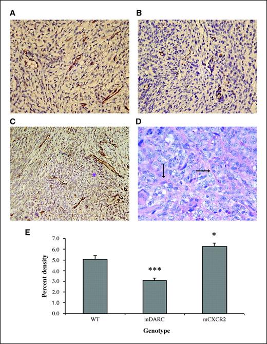 Figure 2. Evaluation of the vascular supply in the tumors arising on PPEP-mCXCR2, PPEP-mDARC, and WT mice. Fixed tumor tissues were immunostained using antibody to PECAM-1 (CD31) to detect blood vessels. A, CD31 staining of vessels in Mela-MIP-2+ melanoma tumors arising on WT mice. B, Mela-MIP-2+ tumors from PPEP-mDARC mice show a marked decrease in blood vessel formation over that seen in the WT control. C, Mela-MIP-2+ tumors from PPEP-mCXCR2 transgenic mice show a significant increase in vessel formation over that seen in the WT control. Images are representative of a minimum of 10 fields per tumor for each tumor from each experiment. D, tumors from PPEP-CXCR2 transgenic mice stained with PAS indicate a network of small microvessels (arrows). E, graph representation of vessel density of all tumors included in both experiments using the quantification method described in Materials and Methods. The Student's t test was used to evaluate the statistical significance of variance between the groups of mice. ***, P < 0.0005; *, P < 0.05. Magnification, ×40.
