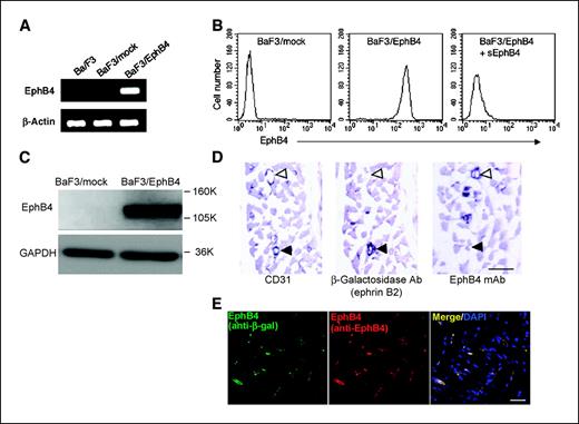 Figure 1. Specificity of generated EphB4 mAb. A, RT-PCR analysis of EphB4 mRNA in BaF3 cells, BaF3 cells transfected with mock (BaF3/mock), or EphB4 (BaF3/EphB4) plasmid. B, FACS analysis of EphB4 expression in BaF3/mock and BaF3/EphB4 cells. Soluble EphB4-FC chimeric protein (sEphB4) was used for analyzing specific binding of EphB4 mAb to EphB4. C, Western blotting analysis for detecting EphB4 protein from cell lysates of BaF3/mock or BaF3/EphB4 with EphB4 mAb and anti-GAPDH antibody. D, serial sections from mouse hind limb muscle of 8-week-old ephrinB2LacZ/+ mice were stained with anti-CD31, anti–β-galactosidase, or anti-EphB4 antibodies. Open and closed arrows, CD31+ephrinB2−EphB4+ and CD31+ephrinB2+EphB4− blood vessels, respectively. Bar, 40 μm. E, sections from mouse hind limb muscle of 8-week-old EphB4LacZ/+ mice were stained with anti–β-galactosidase and anti-EphB4 antibodies. Nuclei were stained with DAPI. Bar, 40 μm.