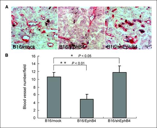 Figure 4. Effect of EphB4 overexpression in B16 cells on tumor angiogenesis. A, blood vessel formation in tumors derived from B16/mock (left), B16/EphB4 (middle), or B16/shEphB4 (right) cells. Sections were obtained from the tumors on day 18 after inoculation with the respective tumor cells and stained with anti-CD31 mAb (red). Bar, 40 μm. B, quantitative evaluation of blood vessels from 30 random fields of three independent tumors, as indicated. *, P < 0.05; **, P < 0.01.