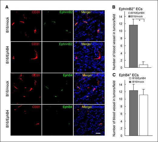 Figure 5. Effect of EphB4 overexpression in B16 cells on the arterial-venous patterning in tumors. A, sections derived from tumors generated by s.c. inoculation of B16/mock (top lane) or B16/EphB4 (second lane) into ephrinB2LacZ/+ mice for 18 d were doubly stained with anti-CD31 (red) and anti–β-galactosidase (green) antibodies. Merged image with CD31 and β-galactosidase staining was shown as indicated. Nuclei were counterstained with Hoechst. Sections derived from tumors generated by s.c. inoculation of B16/mock (third lane) or B16/EphB4 (bottom lane) into EphB4LacZ/+ mice after 18 d were doubly stained with anti-CD31 (red) and anti–β-galactosidase (green) antibodies. Merged image with CD31 and β-galactosidase staining was shown as indicated. Nuclei were counterstained with Hoechst. Bar, 40 μm. B and C, quantitative evaluation of ephrinB2+ arteries (B) or EphB4+ veins (C) from 30 random fields of three independent tumors, as indicated. *, P < 0.05.