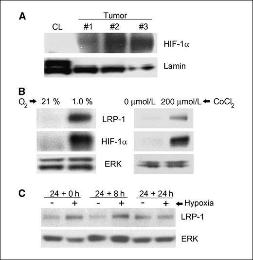Figure 2. Effects of hypoxia on LRP-1 expression. A, to assess hypoxia in xenografts, relative to cells in culture, HIF-1α was measured by immunoblot analysis in 20 μg of nuclear extracts from CL16 cells in normoxic cell culture and from xenografts that were generated in three separate mice (#1–#3). The same blots were reprobed to detect lamin, which was used as a loading control. B, CL16 cells were cultured for 24 h in 21% O2 or in 1.0% O2 (left). Right, CL16 cells were cultured in 21% O2, in the presence or absence of 200 μmol/L CoCl2. Equal amounts of cellular extract (50 μg) were subjected to SDS-PAGE and immunoblot analysis for LRP-1, HIF-1α, and ERK/MAP kinase, as a control for loading. C, CL16 cells were cultured for 24 h under normoxic conditions (−) or hypoxic conditions (+) for 24 h as indicated. All of the cultures were then maintained under normoxic conditions for 0 (24 + 0), 8 (24 + 8), or 24 (24 + 24) h.