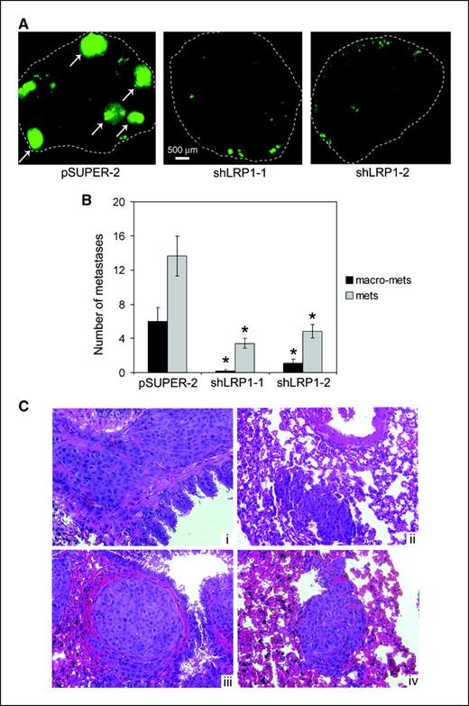 Figure 4. The role of LRP-1 in cancer metastasis from xenografts in mice. A, xenografts were established in mice, using the two cell lines in which LRP-1 was silenced and control pSUPER-2 cells. All three cell lines expressed GFP. At necropsy, the lungs were removed and each lobe was assessed by fluorescence stereomicroscopy for surface metastases. Representative lobes are shown. Dashed line, the outline of the lobe. Arrows, metastases that are >500 μm in maximum diameter. B, lung metastases (mets) on the surfaces of each lobe were counted. The number of macrometastases (macro-mets; >500 μm in maximum diameter) and metastases (100–500 μm in diameter) were determined. Columns, mean; bars, SE (*, P < 0.05, compared with the matched control with pSUPER-2 cells; n = 10–11). C, H&E-stained sections of lungs showing representative metastases formed by pSUPER-2 cells. In (iii), tumor may be filling a blood vessel or lymphatic vessel with clear extravascular invasion.