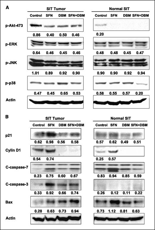 Figure 3. Regulation of cellular survival signaling pathways and proteins by dietary administration of 600 ppm SFN, 1.0% DBM, and combination of 300 ppm SFN and 0.5% DBM in ApcMin/+ mice. A, effects of SFN, DBM, and combinatorial treatments on phosphorylation levels of Akt and MAPKs, including ERK1/2, JNK, and p38 in intestinal tumor and normal-appearing mucosa in ApcMin/+ mice. B, dietary administration of SFN, DBM, or combination of SFN and DBM significantly altered proteins involved in cell cycle regulation and apoptosis.
