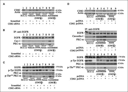 Figure 2. CD82 is required for PKC-α or caveolin-1 to associate with the EGFR and inhibit its phosphorylation. Cells were prepared as indicated in Fig. 1. The expression of CD82 was either disrupted by transfection of human CD82 siRNA or increased by stable transfection of human CD82 cDNA. Cells were starved overnight of serum and EGF and stimulated with 10 nmol/L EGF for 10 min. A and D, top row, CD82 expression was detected by antibody directed against CD82 in total protein from the whole-cell lysates; second row, equal loading was confirmed by probing the same membrane with anti-actin antibody. To assess the association of EGFR with caveolin-1 and PKC-α, EGFR (B, top row and D, third row) was immunoprecipitated from cells with anti-EGFR antibody. The coimmunoprecipitated caveolin-1 (B, second row and D, fourth row) and PKC-α (B, third row and D, fifth row) were detected using an aliquot of immunoprecipitate. To detect EGFR and PKC-α phosphorylation (C and D), total protein from the whole-cell lysate was used. The expression (C, top row and D, sixth row) and tyrosine phosphorylation (C, second row and D, seventh row) of EGFR were detected by antibody directed against EGFR or tyrosine-phosphorylated EGFR, respectively. The expression (C, third row and D, eight row) and phosphorylation (C and D, bottom rows) of PKC-α were detected by anti-PKC-α antibody or anti-phosphorylated PKC-α antibody that specifically identifies the Thr638 phosphorylation site.