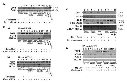 Figure 3. Caveolin-1 and cholesterol-enriched membrane are critical for the effect of PKC-α on EGFR. Cells were prepared as indicated in Fig. 1. The expression of caveolin-1 was disrupted by either stable transfection with human caveolin-1 siRNA (A and B) or transfection of caveolin-1 antisense oligomers (C) or was increased by stable transfection of caveolin-1 cDNA (A and B) into SCC12 cells with or without modified ganglioside expression. Cells were starved overnight of serum and EGF and stimulated with 10 nmol/L EGF for 10 min before protein extraction. A and C, top rows, caveolin-1 expression was detected by antibody directed against caveolin-1 using total protein from the whole-cell lysates. A, bottom row and C, second row, equal loading was confirmed by probing the same membrane with anti-actin antibody. For assessing the association of these molecules, EGFR (B, a, top row) and CD82 (B, b, top row) were immunoprecipitated from cell lysate with anti-EGFR and anti-CD82 antibodies, respectively. The coimmunoprecipitated CD82 (B, a, second row), EGFR (B, b, second row), and PKC-α (B, a and B, b, bottom rows) were detected using an aliquot of the immunoprecipitate. The expression (C, third row) and tyrosine phosphorylation (fourth row) of EGFR were detected in whole-cell lysates by antibodies directed against EGFR and phosphotyrosine EGFR. The expression (C, fifth row) and phosphorylation of PKC-α (bottom row) were detected by either an anti-PKC-α antibody or anti-phosphorylated PKC-α antibody that specifically recognizes Thr638 phosphorylation. D, cholesterol was depleted by treating cells with 5 mmol/L MβCD for 30 min and repleted as described in Materials and Methods. Immunoprecipitation and immunoblotting were done to detect the association of these molecules in control cells, cells depleted of GM3, and cells with increased GM3 content.