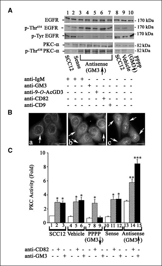 Figure 4. The GM3- and CD82-induced activation of PKC-α leads to translocation of PKC-α and EGFR phosphorylation at Thr654. A, cells were prepared as indicated in Fig. 1 and, at 75% confluence, starved of both serum and EGF overnight. Cells were treated with EGF after incubation with or without 10 μg/mL antibody directed against GM3, 9-O-acetyl GD3 (anti-9-O-AcGD3), CD82, CD9, IgM (control for anti-GM3 and anti-9-O-acetyl GD3 antibodies), or IgG (control for anti-CD82 and anti-CD9 antibodies). For immunoblotting to detect EGFR and PKC-α expression and phosphorylation, total protein from the whole-cell lysate was probed with antibodies directed against EGFR (top row), phosphorylated EGFR at its Thr654 site (second row), phosphotyrosine EGFR (third row), PKC-α (fourth row), and phosphorylated PKC-α at its Thr638 site (bottom row) as described in Materials and Methods. Results with anti-IgM antibody-treated cells resembled those of anti-IgG antibody-treated cells (data not shown). B, cells treated with GM3 or DMSO for 48 h were starved overnight and then stimulated with EGF or TPA as indicated in Materials and Methods. PKC-α localization was detected with anti-PKC-α antibody and FITC-conjugated secondary antibody. Cells were counterstained with DAPI. a, SCC12 cells + EGF alone; b, SCC cells + GM3 + EGF; c, SCC12 cells + TPA (positive control). Arrows, PKC-α at the nuclear membrane (a) and PKC-α translocation to the cell membrane (b and c). Bar, 35 μm. C, in the presence of [γ-32P]ATP, PKC-α activity was detected using immunoprecipitated PKC-α to incubate with its specific substrate as described in Materials and Methods. *, P < 0.05; **, P < 0.01; ***, P < 0.001.
