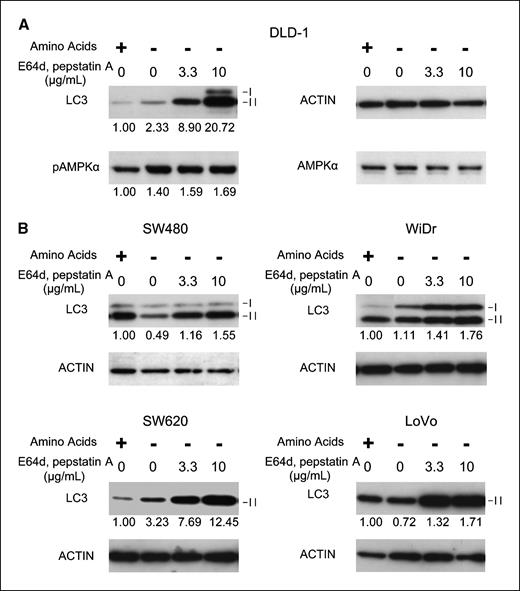 Figure 1. Amino acid starvation induced accumulation of autophagosome-incorporated LC3-II in cultured colorectal cancer–derived cell lines. A, DLD-1 cells were cultured in amino acid–containing or amino acid–deprived medium. Lysosomal protease inhibitors E64d and pepstatin A were added at the indicated concentration. Total cell lysates were collected at 24 h after incubation and submitted for Western blotting to detect phosphorylated AMPKα and LC3 proteins. I, LC3-I; II, LC3-II. Phosphorylated AMPKα density was standardized by total AMPKα, and LC3-II density was standardized by actin. B, colorectal cancer–derived cell lines WiDr, SW620, SW480, and LoVo were treated as above. LC3 proteins were detected and measured by Western blotting.