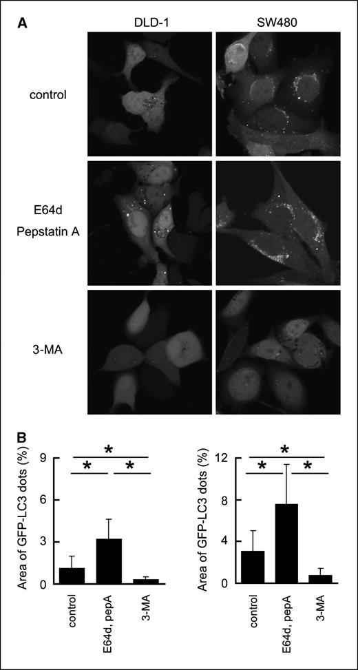 Figure 2. Autophagosome formation was visualized using GFP-LC3–expressing DLD-1 and SW480 cells. A, cells were incubated in amino acid–deprived medium with vehicle (DMSO), 10 μg/mL of E64d and pepstatin A, or 10 mmol/L of 3-MA for 12 h and observed under the confocal laser microscope. B, the area of coarse dots in the cytoplasm was measured and standardized in each cell. At least 100 cells were examined in each treatment. pepA, pepstatin A. Columns, mean percentage of dotted area; bars, SD. *, statistical significance (P < 0.05) in the Student's t test.