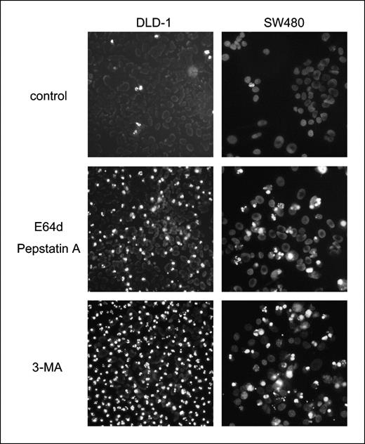 Figure 3. Autophagy inhibitors induced apoptosis of colorectal cancer cell lines during amino acid starvation. SW480 and DLD-1 cells were cultured in an amino acid–deprived medium with vehicle (DMSO), 10 μg/mL of E64d and pepstatin A, or 10 mmol/L of 3-MA for 48 h. Cells were stained with Hoechst 33342. Live cells show intact Hoechst 33342–positive (pale) nuclear staining pattern. Cells in apoptosis show chromatin condensation with dark Hoechst 33342–positive staining.