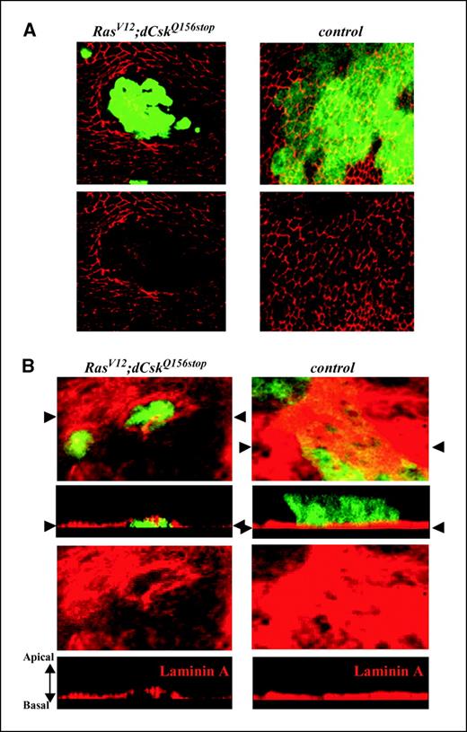 Figure 6. Loss of epithelial polarity and ECM invasion by RasV12;dCsk clones. A, DE-cadherin staining (red) in GFP-labeled eye clones of cells with the genotypes dRasV12;dCskQ156Stop (left) or wild-type controls (right). Note that unlike controls, dRasV12;dCskQ156Stop clones displayed rounded morphology, reduced or delocalized DE-cadherin staining and detached cells. B, laminin A staining (red) was used to label the ECM. Clonal eye tissue from the following genotypes was marked by the presence of GFP: dRasV12;dCskQ156Stop (left) and wild-type controls (right). Arrowheads, position of the optical sections. Unlike control clones, dRasV12;dCskQ156Stop clones were occasionally embedded within the basal ECM.