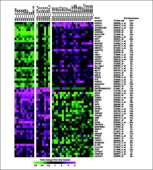 Figure 1. Gene expression signature of cervical SCCs. Differentially expressed genes were identified by asking that comparisons of SCCs to HSILs as well as SCCs compared with normal cervix samples both give P < 0.001 from a one-way ANOVA and show at least 2.5-fold difference in the means. This comparison yielded 29 genes with higher expression in SCCs and 31 genes with lower expression in SCCs relative to the other groups. Fold change from the median level in normal cervix samples and gene location with respect to chromosome arm are shown.