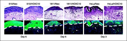 Figure 5. HOXC10 overexpression enhances invasion of 610, 1811, and HeLa cells in the chick CAM. Top row, the indicated cell lines were implanted on the CAM surface and at the indicated time points, CAM tissues were harvested, fixed, and stained with H&E. Bottom row, the same CAM tissues shown in the top row were also visualized by fluorescence because the implanted cells were labeled with Fluoresbrite carboxylated polystyrene nanospheres. The CAM surface is demarcated by dashed white lines. Arrowheads, cells invading the CAM.