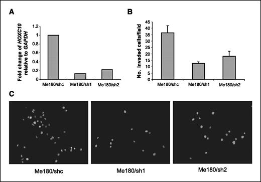 Figure 6. shRNA-mediated knockdown of HOXC10 expression inhibits invasion of ME180 cells. A, HOXC10 expression relative to GAPDH was analyzed by qRT-PCR in ME180 cells expressing two independent shRNAs (sh1 and sh2) and one scrambled control shRNA (shc). B, ME180 cells with shRNA-mediated knockdown of HOXC10 expression (ME180/sh1 and ME180/sh2) show decreased invasion through Matrigel-coated transwells compared with matched control (ME180/shc) cells. Columns, mean of cells counted in five fields in each of three independent experiments; bars, SD. C, representative photomicrographs of ME180/shc, ME180/sh1, and ME180/sh2 cells penetrating the membrane.