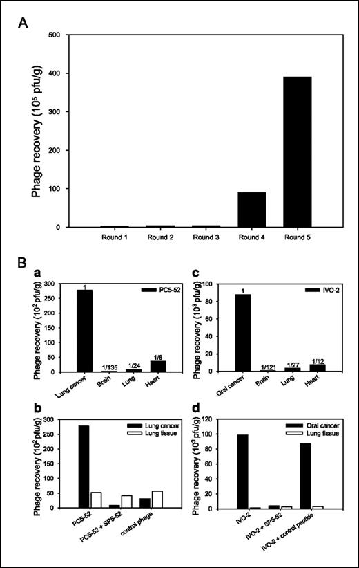 Figure 1. Selection of lung cancer–targeting phages by in vivo phage display. A, a phage-displayed peptide library was injected through the tail vein of tumor-bearing mice. Phage recovered from the tumor was amplified and re-injected in four consecutive rounds. After the fifth round of biopanning (lane 5), the recovery rate of the phages had increased 156-fold over that of the first round. B, identification of specificity of tumor-homing phage. a, SCID mice bearing human lung cancer xenografts were injected i.v. with PC5-52 phage, and phage was recovered after perfusion. Recovery of PC5-52 phage from the tumor was higher than from brain, lungs, and heart. Phage titer in control organs compared with tumor tissues is indicated. b, recovery of lung cancer–homing phage was competitively inhibited by the synthetic peptide SP5-52. A background level of phage titer was recovered from the tumor mass of mice treated with a control phage. c, SCID mice bearing human oral cancer xenografts were injected i.v. with IVO-2 phage, and phage was recovered after perfusion. The results show that IVO-2 phage exhibits marked homing to the tumor compared with the control organs (brain, lungs, and heart) in the same mouse. Phage titer in control organs compared with tumor tissues is indicated. d, recovery of oral cancer–homing phage is competitively inhibited by the synthetic peptide SP5-52. However, control peptides have no such effect.