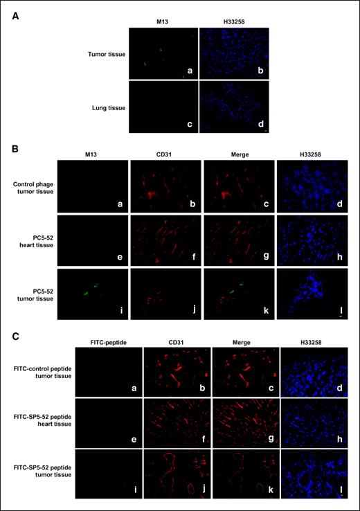 Figure 2. Localization of phages displaying tumor-homing peptide. A, immunofluorescent localization of PC5-52 after i.v. injection into human lung cancer bearing mice. The immunoreactivity of phages are localized in tumor masses (a), whereas no reaction product is observed in normal lungs (c). b and d, cells counterstained for nuclear DNA with H33258 corresponding to a and c, respectively (bar, 20 μm). B, investigation of tumor-homing phage binding to tumor vessels of lung cancer xenograft. Mice were injected with tumor-homing phages by i.v. injection. Tumor and organ tissues were immunostained with anti-M13 and anti-CD31 antibodies. Anti-phage immunofluorescence is colocalized with anti-CD31 on tumor neovasculature endothelia after phage injection (i, j, and k). Control phage cannot bind to tumor vessels (a). The tumor-homing phage cannot recognize the normal heart (e). Anti-CD31 in heart vessels (f and g) and xenograft tumor vessels (b, c, j, and k). Nuclear staining by H33258 (d, h, and l). C, binding of FITC-labeled SP5-52 peptide to tumor vessels of lung cancer xenografts. FITC-labeled SP5-52 could bind to human lung cancer xenograft sections (i) and colocalizes with anti-CD31 on tumor neovasculature (k). An FITC-labeled control peptide did not bind lung cancer xenografts (a) and SP5-52 did not bind to a control heart tissue (e). Anti-CD31 in the human lung cancer xenografts (b and j) and normal heart (f) vessels. Nuclear staining by H33258 in d, h and l (bar, 20 μm).