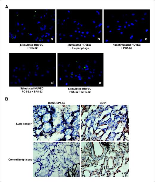 Figure 4. Targeting phages react with VEGF-stimulated HUVECs and bind to endothelial cells of human tumors. A, PC5-52 phages were incubated with VEGF-stimulated HUVECs. Unbound phage particles were washed off and the HUVECs immunostained with FITC anti-M13 antibodies. The specific reactivity of PC5-52 on stimulated HUVECs (a). The control helper phage does not react with stimulated HUVECs (b). PC5-52 exhibits no specific reactivity with nonstimulated HUVECs (c). SP5-52 (d) but not MP5-52 (e) can compete with PC5-52 for binding to stimulated HUVECs. Nuclear staining was by H33258 (bar, 20 μm). B, immunohistochemical localization of biotin-labeled SP5-52 on human lung adenocarcinoma specimens. The biotin-labeled peptide was incubated with frozen sections of surgical specimens and subjected to routine immunohistochemical staining. The targeting peptide was detected in tumor tissue (a), but not in non–tumor lung tissue (c). CD31 was detected both in vessels of tumor tissue (b) and in control lung tissue (d) (bar, 20 μm).