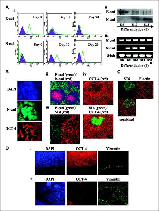 Figure 1. Human ES cell differentiation is associated with loss of cell surface E-cadherin and gain of cell surface N-cadherin and 5T4 proteins. HES4 ES cells were maintained in an undifferentiated state by culture in ES cell medium in the presence of a fibroblast feeder layer, and were differentiated in monolayer culture by transfer of the cells to gelatin-treated plates, as described previously (35). A, (i) cell surface E-cadherin (E-cad) and N-cadherin (N-cad) proteins were assessed in undifferentiated HES4 ES cells (day 0) and cells differentiated for 10 and 20 d by fluorescent flow cytometry in a Becton Dickinson FACScalibur. E-Cadherin or N-cadherin (open population); isotype cAbs (closed population). Viable cells were gated using forward and side scatter and the data represents cells from this population. (ii) Western blot analysis was done to assess total cellular E-cadherin (E-cad) or N-cadherin (N-cad) proteins in HES4 ES cells differentiated for 5, 10, and 15 d (as described above). (iii) RT-PCR analysis of E-cadherin (E-cad), N-cadherin (N-cad), and β-tubulin (β-tub—control) transcript expression was assessed in undifferentiated HES4 ES cells (day 0) and in cells differentiated for 5, 10, 15, and 20 d as described above. B, (i) immunofluorescent microscopy analysis of N-cadherin (N-cad) and OCT-4 protein expression in HES4 ES cells cultured in ES cell medium for 12 d to promote spontaneous differentiation. Note that N-cadherin expression correlates with the absence of the pluripotent marker OCT-4. (ii) HES4 ES cells were differentiated as described in B (i) and assessed for E-cadherin (green) and N-cadherin (red) expression using fluorescent microscopy. Note discrete areas of N-cadherin protein expression in the absence of E-cadherin. (iii) Confocal microscopy image of HES4 cells cultured as described in B (i) and assessed for expression of E-cadherin protein (green) and 5T4 antigen (red) showing discrete cell surface expression of these two proteins. Note that very low levels of 5T4 antigen were detected in the cytoplasm of E-cadherin–positive cells. (iv) HES4 ES cells were differentiated as described in B (i) and assessed for 5T4 antigen (green) and OCT-4 protein (red) expression using fluorescent microscopy. Note that expression of 5T4 protein was associated with loss of the pluripotent marker OCT-4. C, confocal microscopy analysis of HES4 cells cultured as described in B (i) and assessed for filamentous actin (red) and 5T4 antigen (green). Note the discrete cell surface expression of 5T4 in differentiated cells. D, (i) immunofluorescent microscopy analysis of vimentin (green) and OCT-4 protein (red) expression in undifferentiated HES4 ES cells. Note that OCT-4–positive cells exhibit little expression of vimentin. (ii) Immunofluorescent microscopy analysis of vimentin and OCT-4 protein expression in HES4 ES cells cultured in ES cell medium for 12 d to promote spontaneous differentiation. Note that ES cell differentiation is associated with increased expression of vimentin and loss of OCT-4.