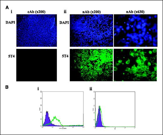 Figure 6. 5T4 antigen is localized at the plasma membrane following abrogation of E-cadherin–mediated cell-cell contact. A, undifferentiated HES4 ES cells were treated with (i) cAb or (ii) E-cadherin nAb SHE78.7 (nAb) for 8 h and assessed for DAPI (total number of cells, nuclei, within the field of view) and 5T4 antigen expression by immunofluorescent microscopy (magnification, ×200 and ×630). B, (i) undifferentiated HES4 ES cells were treated with control (cAb; filled population) or nAb (open population) and assessed for cell surface expression of the 5T4 antigen using fluorescent flow cytometry. Viable cells were gated using forward and side scatter and the data represents cells from this population. Note that 5T4 antigen is detected at the cell surface of nAb-treated ES cells. (ii) Analysis of cell surface 5T4 expression in HES4 ES cells treated with either cAb (closed population) or nAb (open population) and subsequent removal of the antibodies for 5 d was assessed using fluorescent flow cytometry. Viable cells were gated using forward and side scatter and the data represents cells from this population. Note that removal of nAb resulted in similar levels of 5T4 antigen at the cell surface compared with cAb-treated cells.