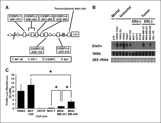 Figure 2. Elafin gene is transcriptionally down-regulated through its promoter in most breast tumor cells. A, structure of the elafin promoter-luciferase vector. Schematic representation of the human elafin promoter-luciferase constructs (pSPL1000). Numbering is relative to the first base of the ATG translation codon. The region of transcription start site and consensus binding sites for known transcription factors are indicated. B, the elafin mRNA levels is down-regulated in most breast tumor cell lines. Each lane contains 20 μg of total RNA. The blots were hybridized with a 0.6-kb elafin cDNA probe. The amount of loaded RNA was normalized by 36B4 mRNA and 28S rRNA. C, comparison of the elafin promoter activity among different cell lines. Human immortalized mammary epithelial cells (76NE6 and MCF-10A) and human breast cancer cells (ZR75T, MCF-7, MDA-MB-231, and MDA-MB-436) were plated in six-well plates. At 24 h after cell plating, cells were cotransfected with the human elafin promoter-luciferase reporter constructs pSPL1000 and pRL-TK vector, which served as an internal control. At 24 h after transfection, the cell lysates were collected for luciferase assay. The firefly luciferase activity of each sample has been normalized by its Renilla luciferase activity. Columns, means; bars, SD; n = 3. *, P < 0.05.