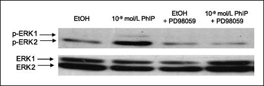 Figure 6. The effect of PhIP on the phosphorylation status of ERK1 and ERK2 in PC-3 cells in the presence of the MEK1/2 inhibitor PD98059 (50 μmol/L). Phosphorylated and total forms of ERK1/2 were evaluated by immunoblotting with protein extracts obtained from PC-3 cells treated with PhIP and PD98059 in serum-free medium.