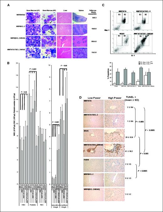 Figure 1. Triple transgenic MMTVtTA/TBCL-2/NRASD12 mice develop high-risk MDS, whereas MRP8[BCL-2/NRASD12] transgenic mice show AML progression. A, H&E-stained bone marrow smears and organ sections showing increased marrow blasts [low-power (LP) magnification, ×40] with liver and spleen infiltration in the triple transgenic mice. At high power (HP, ×120), representative normal neutrophils are arrowed (N in black), as well as dysplastic cells (D arrowed in black) and quantified blast cells (B arrowed in white). MRP8[BCL-2/NRASD12] spleen sections show a reduction and dispersion of the white pulp and increase of the red pulp due to an increase in extramedullary hematopoiesis, also seen in the liver. As previously reported, single MRP8BCL-2 or MRP8NRASD12 transgenic mice show no leukemic phenotype in liver and spleen sections during the time of observation of up to 6 mo (24, 49). Nevertheless, the spleens of MRP8NRASD12 mice are enlarged; this is due to reactive proliferation of cells as a result of their susceptibility to develop infections and not to malignancy. This phenomenon has been previously described as a susceptibility of these mice to develop hyperkeratotic lesions, which become secondarily infected with fecal flora, resulting in the proliferation of myeloid cells (24). Significantly increased blast cell populations were observed in bone marrow samples of single MRP8BCL-2 versus FVB/N mice (P < 0.005; n = 5) and MRP8[BCL-2/NRASD12] versus FVB/N mice (P < 0.00005; n = 4). B, histograms of blood counts demonstrating increased WBC, reduced platelet counts with unchanged RBC, and increased organ/body weight ratios. C, bone marrow immunophenotyping: The MMTVtTA promoter drives disease with expansion toward the myeloid compartments (Mac-1/Gr-1), showing in MMTVtTA/TBCL-2/NRASD12 increased R1 to R2 ratio (bottom), thus depicting a blast cell expansion. Representative of three independent experiments. D, TUNEL staining of paraffin-embedded liver sections; low-power (×200) and high-power (×600) magnifications show significantly increased apoptosis in MMTVtTA/TBCL-2/NRASD12 versus controls. Three fields were counted in each of the two mice in each group.