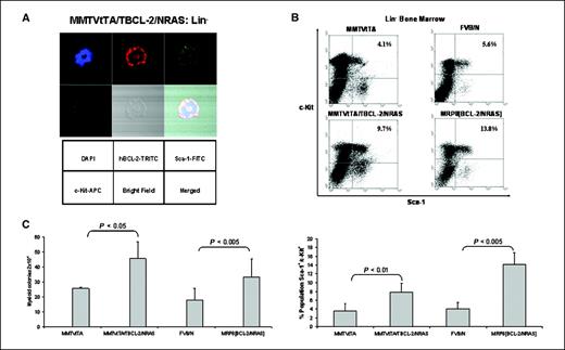 Figure 2. Stem cell compartmentalization of MDS- and AML-like disease models. A, confocal microscopy showing colocalization of the transgene hBCL-2 with Sca-1 and c-Kit in representative samples (of three independent experiments) of Lin−/Sca-1+/c-Kit+ sorted bone marrow cells of MMTVtTA/TBCL-2/NRASD12 (counterstained with 4′,6-diamidino-2-phenylindole). B, top, representative immunophenotype trace of Lin− sorted bone marrow samples from controls and diseased animals (bottom) with significant difference in the Sca-1+/c-Kit+ population. Columns, mean of n = 5 MMTVtTA/TBCL-2/NRASD12 and n = 3 MRP8[BCL-2/NRASD12] mice analyzed; bars, SD. C, histogram showing numbers of day 12 to 14 CFU-GM from bone marrows of diseased and normal mice. Columns, mean of n = 7 MMTVtTA/TBCL-2/NRASD12 and n = 5 MRP8[BCL-2/NRASD12] mice analyzed; bars, SD.