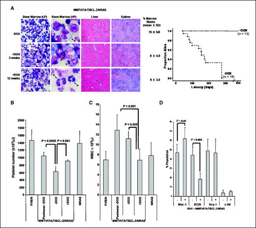 Figure 3. MMTVtTA/TBCL-2/NRASD12 MDS-like disease is stable after inhibition of BCL-2 expression and rescue from lethality. A, left, bone marrow smears and organ sections (H&E stained as in Fig. 1A) of mice without (−DOX) and with (+DOX) doxycycline after 3 and 12 wk illustrate a persistence of marrow blast (visualized at low-power magnification, ×40) and infiltrated liver and spleens. Doxycycline-treated mice have increased mature neutrophils. High-power magnification (×120) of bone marrow show representative normal neutrophils (N arrowed in black), dysplastic cells (arrowed D in black), and quantified blast cells (B arrowed in white). Right, Kaplan-Meier survival curves of triple transgenic mice in the absence and presence of doxycycline showing rescue of lethality by switching BCL-2 expression off. Vertical lines, censored animals taken off doxycycline. Blood index measurements: after weaning at 3 wk old, 3 to 6 mo from birth, and 3 wk after doxycycline administration. B, reduced peripheral blood platelet counts are indicative of disease where rescue was observed with partial recovery of platelet counts in the presence of doxycycline compared with that in the absence of doxycycline. Columns, mean (n = 7); bars, SD. C, with WBC counts after weaning at 3 wk old, in the absence compared with that in the presence of doxycycline. Columns, mean (n = 7); bars, SD. D, histogram of peripheral blood immunophenotyping of the same mice before and after doxycycline treatment of MMTVtTA/TBCL-2/NRASD12 mice showing expansion of the myeloid and reduced B-cell compartments. The increase in Mac-1 after BCL-2 expression is switched off possibly due to increased myelopoiesis as there is a reduction in B220+ cells, where BCL-2 expression is normally driven by the MMTVtTA. The total Sca-1+ population remains unchanged.