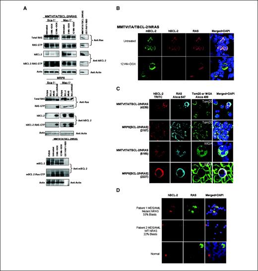 Figure 4. Increased RAS activity in Sca-1+ cells of MRP8[BCL-2/NRASD12] and MMTVtTA/TBCL-2/NRASD12 mice due to BCL-2:RAS-GTP complexing and colocalization of the complex. A, top, Sca-1+ and Mac-1+ sorted spleen cells from MMTVtTA/TBCL-2/NRASD12 mice without (Untreated) or with doxycycline treatment for 3 and 12 wk; middle, wild-type FVB/N, MRP8BCL-2, MRP8NRASD12, and MRP8[BCL-2/NRASD12] mice were assessed for total RAS expression by Western blotting and total BCL-2 expression by reprobing the blots with a human specific anti–BCL-2 antibody (hBCL-2). Active RAS-GTP levels were assessed via a sensitive RAF1-RBD pull-down assay followed by Western blotting with an anti-RAS antibody. Blots were reprobed with anti-actin antibody to assess protein loading. Results shown are representative of three independent experiments. Bottom, RAF1-RBD pull-down assay of FVB/N, untreated, and doxycycline-treated diseased MMTVtTA/TBCL-2/NRASD12 mice, demonstrating persistence of mBCL-2:RAS-GTP complex irrespective of hBCL-2 levels. B, immunofluorescence microscopy of MMTVtTA/TBCL-2/NRASD12 mice bone marrow cells shows loss of human BCL-2 (hBCL-2) in the presence of doxycycline for 12 wk. DAPI, 4′,6-diamidino-2-phenylindole. C, confocal microscopy showing subcellular localization of BCL-2:RAS complex. hBCL-2, RAS, and mitochondria (Tom20) or plasma membrane (WGA) stained cells of unsorted bone marrow cells in MMTVtTA/TBCL-2/NRASD12 and MRP8[BCL-2/NRASD12] mice showing mitochondrial localization of hBCL-2 and RAS in MRP8[BCL-2/NRASD12] mice and reduction of mitochondrial colocalization in MMTVtTA/TBCL-2/NRASD12 mice, with plasma membrane colocalization of MMTVtTA/TBCL-2/NRASD12 and a reduction of colocalization with WGA in the MRP8[BCL-2/NRASD12] mice (representative of at least three independent experiments). D, colocalization of BCL-2 and RAS when NRAS is mutated in human samples. Immunofluorescence microscopy of bone marrow cells from patient 1 with a secondary MDS/AML presenting with mutant NRAS, and from patient 2 with secondary MDS/AML with wild-type NRAS and normal human bone marrow. Colocalization of hBCL-2 and RAS is observed only in the presence of mutant NRAS.