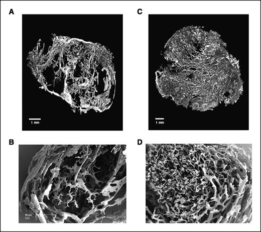 Figure 2. Three-dimensional tumor microvascular architecture as shown by corrosion casting. A and C, volume renderings from micro-CT data of whole LS174T and SW1222 tumors, respectively, showing the more patchy and heterogeneous distribution in LS174T. B and D, scanning electron micrographs showing high-power detail of vessels in LS174T and SW1222, respectively.