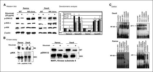Figure 3. Hyperactivation of the NF-κB and ERK1/2 survival pathways in the RR clones. After overnight growth in RPMI 1640 + 1% FBS, RR clones were washed and grown in complete medium ± rituximab (20 μg/mL, 24 h). A, total cell lysates (40 μg) were subjected to Western blot analysis using phosphospecific antibodies for various components of the NF-κB and ERK1/2 pathways. B, the kinase activity of the IKK complex using IκB-α peptide (amino acids 1–50 including S32/36) and ERK1/2 using MAPK kinase substrate 4 (amino acids 172-192) using immunocomplex kinase assay. C, after overnight growth in RPMI 1640 + 1% FBS, cells were washed and were grown in complete medium (± rituximab, DHMEQ, or PD098059). Ten micrograms of nuclear lysates were subjected to EMSA (n = 2; refs. 19, 20).
