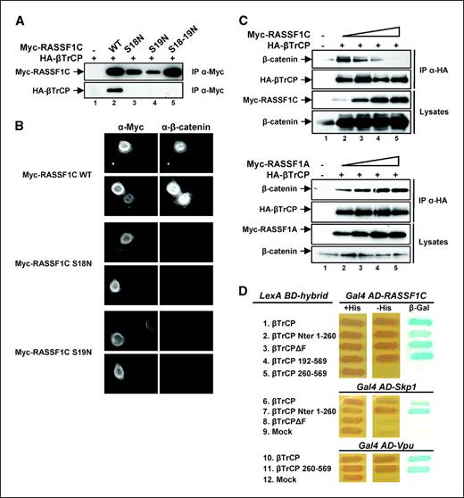 Figure 3. RASSF1C-mediated β-catenin accumulation requires binding to βTrCP. A, serine S18 and S19 of RASSF1C are required for binding to βTrCP. Lysates from transfected HeLa cells expressing HA-βTrCP alone (lane 1), or HA-βTrCP coexpressed with Myc-RASSF1C (WT), Myc-RASSF1C S18N, S19N, or S18-19N mutants (lanes 2–5) were immunoprecipitated with anti-Myc antibodies. Lysates and immunoprecipitates were subjected to Western blot using anti-Myc (top) or anti-HA antibodies (bottom). B, RASSF1C-mediated β-catenin accumulation requires binding to βTrCP. HeLa cells expressing wild-type Myc-RASSF1C (two top panels) or the mutants Myc-RASSF1C S18N (two middle panels), S19N (two bottom panels), or S18-19N (not shown) were analyzed by immunofluorescence using anti-Myc-TRITC (left panels) or anti–β-catenin antibodies (right panels). C, RASSF1C but not RASSF1A can inhibit β-catenin association to βTrCP. Lysates from HeLa cells coexpressing HA-βTrCP and increasing amounts of Myc-RASSF1C (top) or Myc-RASSF1A (bottom) were immunoprecipitated with anti-HA antibodies. Lysates and immunoprecipitates were analyzed by Western blot using anti–β-catenin, anti-HA, or anti-Myc antibodies as indicated. D, the βTrCP NH2-terminal domain but not the COOH-terminal substrate binding domain interacts with RASSF1C. The yeast reporter strain L40 expressing the pairs of indicated hybrid proteins was analyzed for histidine auxotrophy and β-galactosidase expression. Transformants were plated on medium with histidine (+His, left), without histidine (−His, middle), or replica-plated on Whatman filters and tested for β-galactosidase activity (β-gal, right). Growth in the absence of histidine and blue color in the β-galactosidase assay indicate interaction between hybrid proteins.