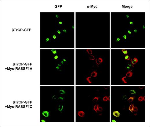 Figure 4. Exogenous RASSF1C can change the subcellular localization of βTrCP from nucleus to cytoplasm. HeLa cells expressing βTrCP-GFP alone (top), or together with Myc-RASSF1A (middle) or with Myc-RASSF1C (bottom), were analyzed by direct fluorescence and by indirect immunofluorescence using anti–Myc-TRITC antibodies. Cells were observed by confocal microscopy.