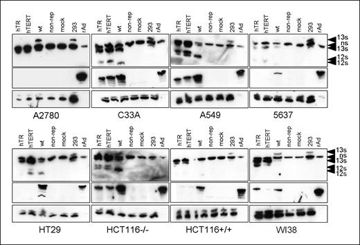 Figure 4. Western blot analysis of E1A and hexon expression in infected cells. Cells were mock infected or pulse infected with 100 i.u. per cell of Ad-hTR-E1, Ad-hTERT-E1, Ad-WT, or nonreplicating control. Forty-eight hours postinfection, cells were harvested for protein extraction. Blots were probed for expression of E1A, hexon, or ERK (as loading control). Each blot included the following internal controls: 15 μg HEK293 cell extracts and 108 i.u. purified recombinant adenoviruses (rAd). Representative blot for each cell line. All experiments were repeated at least twice.