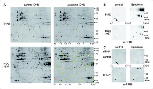 Figure 1. Proteomic screen for proteins affected by epirubicin treatment. A, T47D cells (top) and HCC1937 cells (bottom) were either untreated or treated with 0.2 μg/mL of epirubicin for 3 h and lysed with 7 mol/L urea/2 mol/L thiourea–containing buffer. Protein (50 μg) from untreated and epirubicin-treated cells was labeled with Cy3 (left) and Cy5 (right), respectively. The differently labeled samples were mixed together, resolved on a two-dimensional gel (pH range 3–10, left to right), and scanned with a fluorescence image analyzer. Yellow arrows, protein spots whose levels were significantly altered after epirubicin treatment. Red arrows, proteins that significantly decreased only in T47D cells after epirubicin treatment. The slower-migrating protein was identified as RPB8 and the faster one was myosin light chain. B, T47D cells or HCC1937 cells were treated as in A and lysed with 7 mol/L urea/2 mol/L thiourea–containing buffer. Lysates (500 μg) were resolved on a two-dimensional gel (pH range 3–10). A part of the gel was subjected to immunoblot with anti-RPB antibody. Arrow, RPB8. C, T47D cells were transfected either with control siRNA (top) or with siRNA for BRCA1 (bottom), treated with or without epirubicin, and subjected to anti-RPB8 immunoblotting as in B.