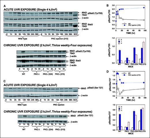 Figure 1. UVR treatment leads to constitutive phosphorylation of Stat3 at both Tyr705 and Ser727 residues. PKCε transgenic mice (line 215) and their wild-type littermates (four mice per group) were exposed to a single UVR dose (4 kJ/m2). The mice were sacrificed at 1, 3, 6, 12, 18, 24, and 96 h after UVR exposure. In a parallel experiment, PKCε (line 215 and 224), PKCδ transgenic mice (50), and their wild-type littermates (four mice per group) were exposed to chronic UVR exposure [2 kJ/m2, four times (Monday, Wednesday, Friday, and Monday)]. The mice were sacrificed at 1 and 3 h after the fourth treatment of UVR. The mouse epidermis was scraped off and total lysates were prepared. The epidermal extract (25 μg protein) was subjected to SDS-PAGE followed by immunoblot analysis with pStat3Tyr705 (A), pStat3Ser727 (C), and whole Stat3 (A) antibodies from Cell Signaling Technology, Inc. (Beverly, MA). Equal loading was confirmed by stripping the blot and reprobing it for β-actin. The quantification of proteins (normalized to β-actin; B and D) was done by densitometry analysis using Total Lab Nonlinear Dynamics Image Analysis Software (Nonlinear USA). Y axis, relative numbers. Columns, mean of Western blots of epidermal extracts from four different mice; bars, SE. Shown is the Western blot of pooled epidermal extracts from four mice. Similar results were obtained in a repeat experiment.