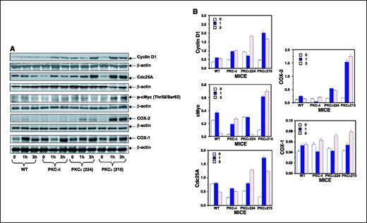 Figure 3. UVR treatment leads to increased expression of Stat3-regulated genes. As described in the legend to Fig. 1, epidermal extract prepared after chronic UVR exposures was used to analyze cyclin D, c-myc, cdc25A, and COX-2 expression (A). The quantification of proteins (normalized to β-actin) was done by densitometric analysis using TotalLab Nonlinear Dynamics Image Analysis Software (Nonlinear USA; B). Y-axis, arbitrary numbers. Columns, mean of Western blots of epidermal extracts from four different mice; bars, SE. Shown is the Western blot of pooled epidermal extracts from four mice. Similar results were obtained in a repeat experiment.